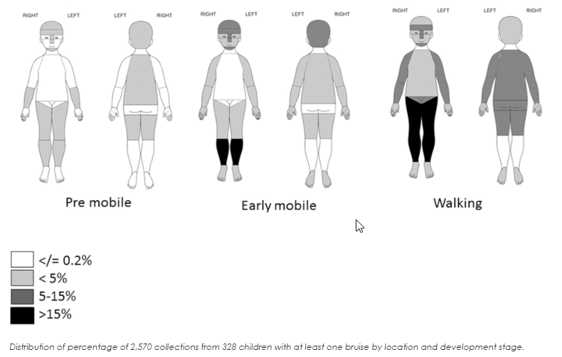 body map of bruising patterns